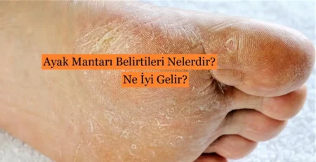 Ayak Mantarı Nedir? Belirtileri Nelerdir? Ayak Bakimi